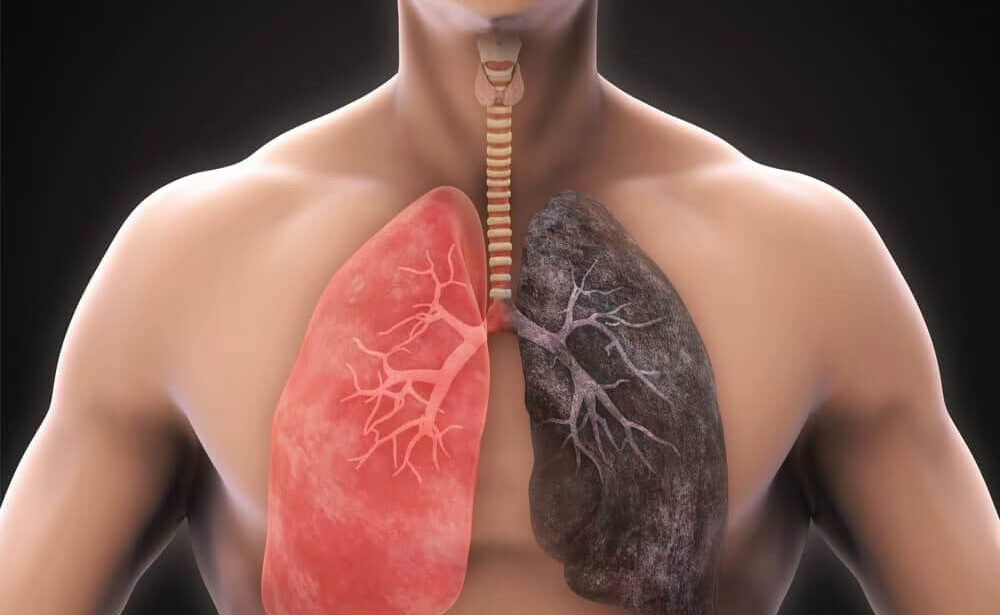 COPD Specialist in Kitchener